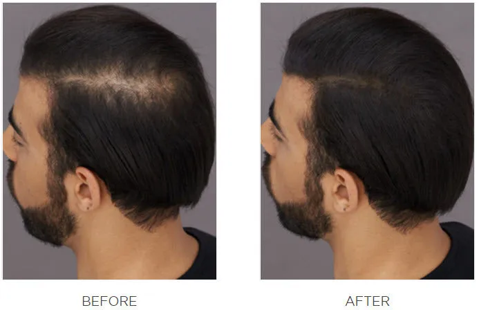 Toppik Hair Building Fibers