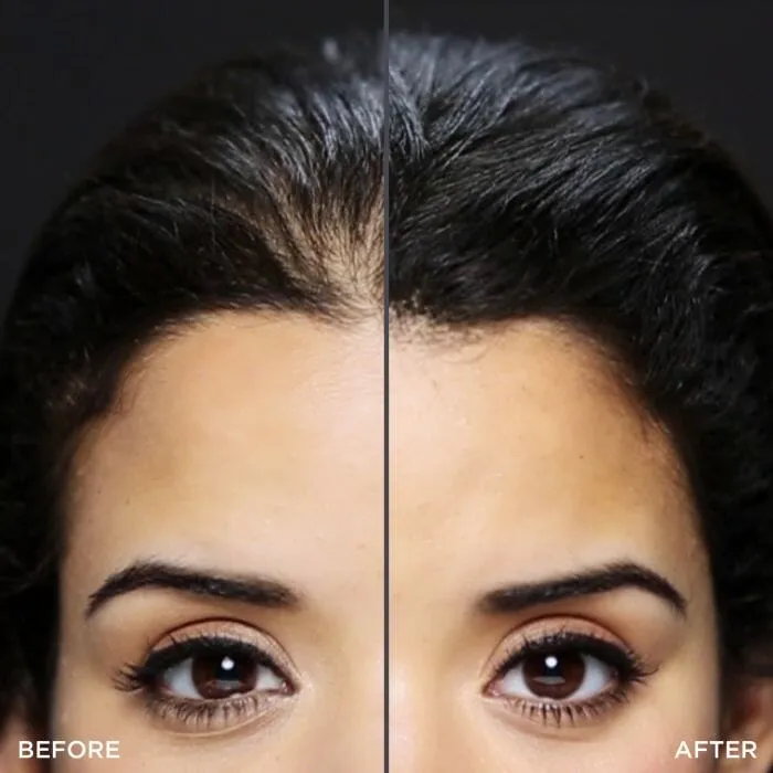 Toppik Hairline Optimizer